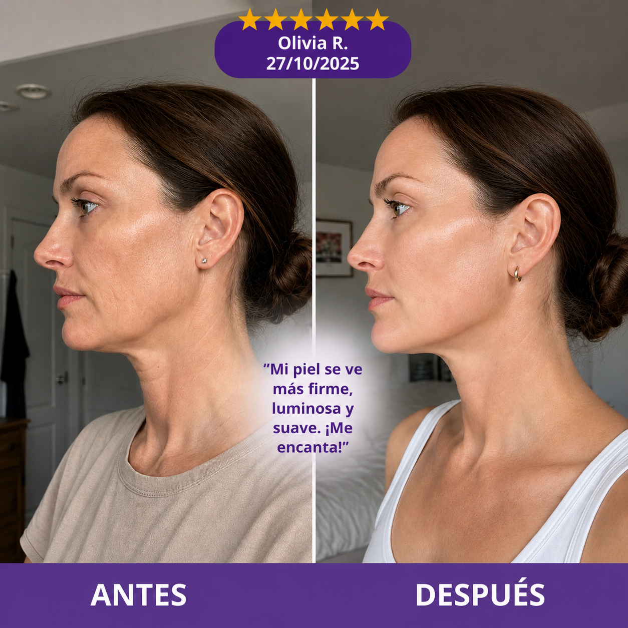 Lumi Lift™