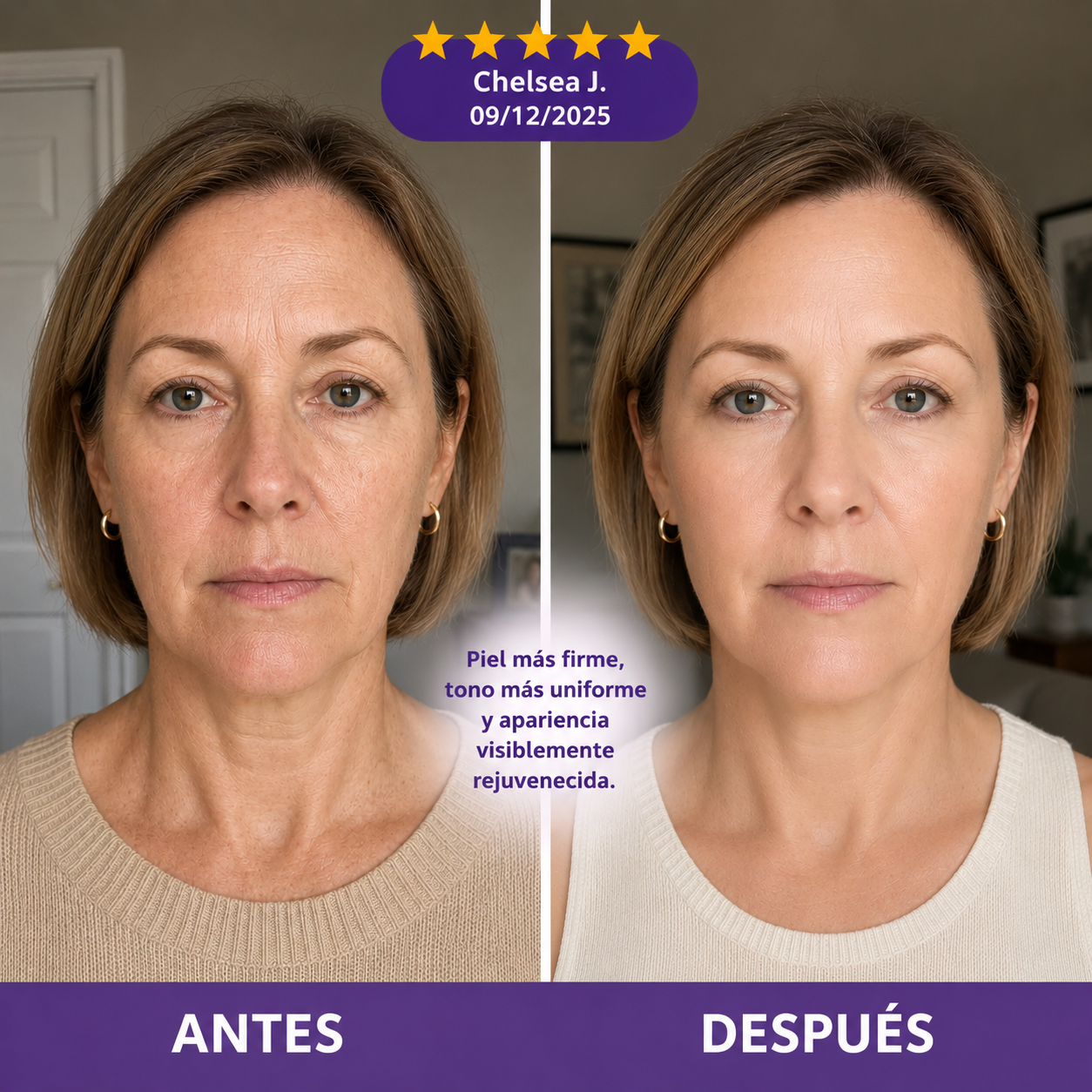 Lumi Lift™
