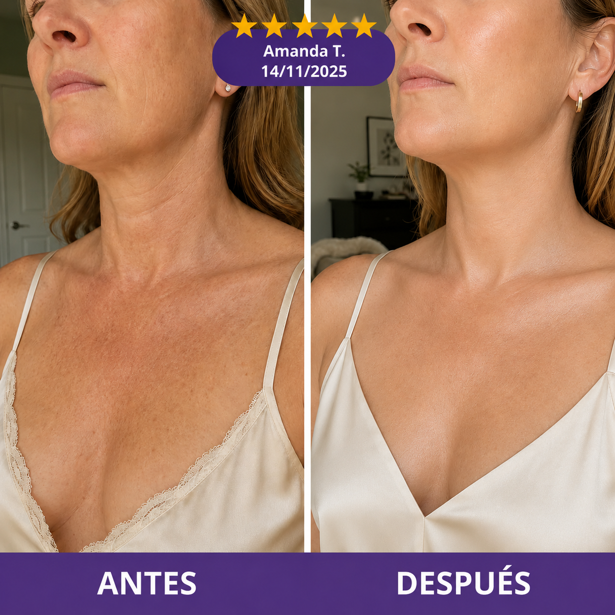 Lumi Lift™