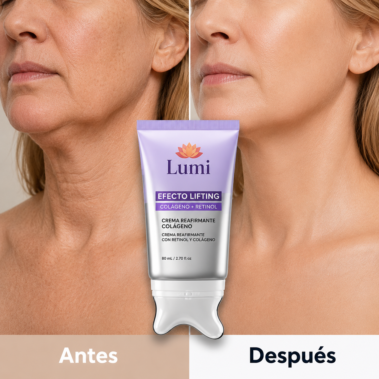 Lumi Lift™